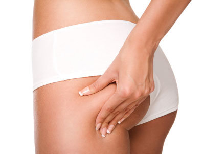 Treatment bei Cellulite